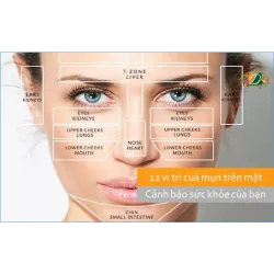 12 vị trí của mụn trên khuôn mặt cảnh báo sức khỏe của bạn