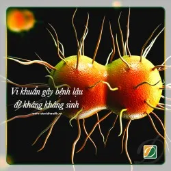 BỆNH LẬU ĐANG VƯỢT NGOÀI TẦM KIỂM SOÁT CỦA GIỚI Y KHOA