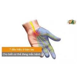 Bàn tay xuất hiện 7 dấu hiệu sau chứng tỏ cơ thể đang có bệnh “giấu mặt”