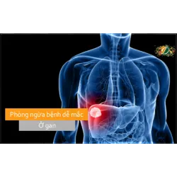 Phòng ngừa bệnh dễ mắc ở gan