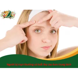NGƯỜI BỊ MỤN THƯỜNG SỐNG LÂU HƠN