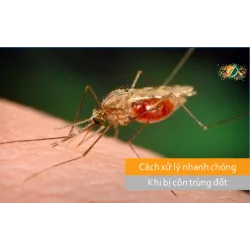 Cách xử lý nhanh chóng khi bị côn trùng đốt