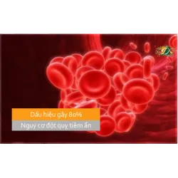Điểm danh những dấu hiệu gây 80% nguy cơ đột quỵ tiềm ẩn