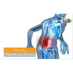 Đau lưng, coi chừng trượt đốt sống thắt lưng