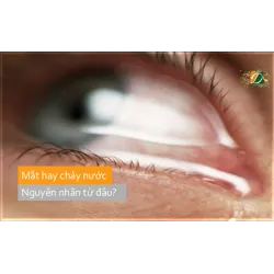 Tại sao mắt hay bị chảy nước