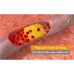 Tổng quan và cách ăn kiêng cho người bị máu nhiễm mỡ