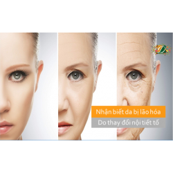 Khi làn da là tấm gương phản chiếu lão hóa do nội tiết