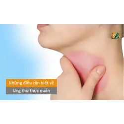 Những điều cần biết về bệnh ung thư thực quản