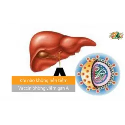 Khi nào không nên tiêm vaccin phòng viêm gan A