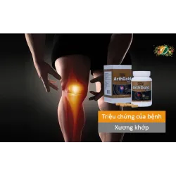 Triệu chứng của bệnh cơ xương khớp